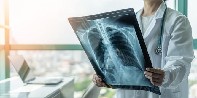 Gruźlica to ciężka choroba płuc, która często bywa wykrywana przypadkowo
