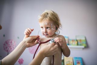 Ospa wietrzna - przyczyny, objawy, przebieg, leczenie. Jak zapobiec ospie?