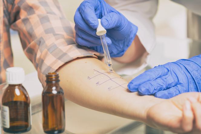 Badania alergologiczne (testy alergiczne)