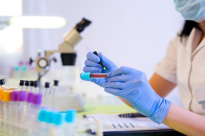 Kobieta pracującą w laboratorium oznacza próbkę krwi do badania.